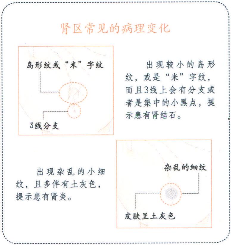 手掌上的腎區(qū)